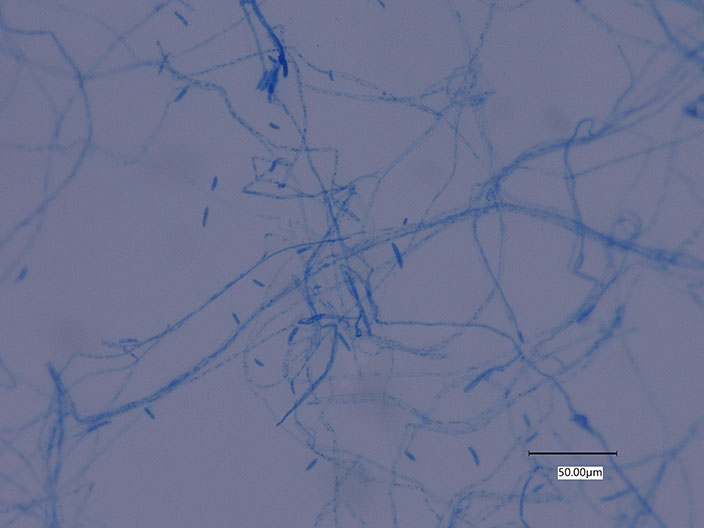 Hyphae stained visible under the microscope