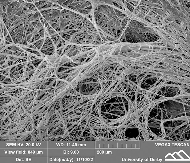 Hyphae visible form the scanning electron microscope